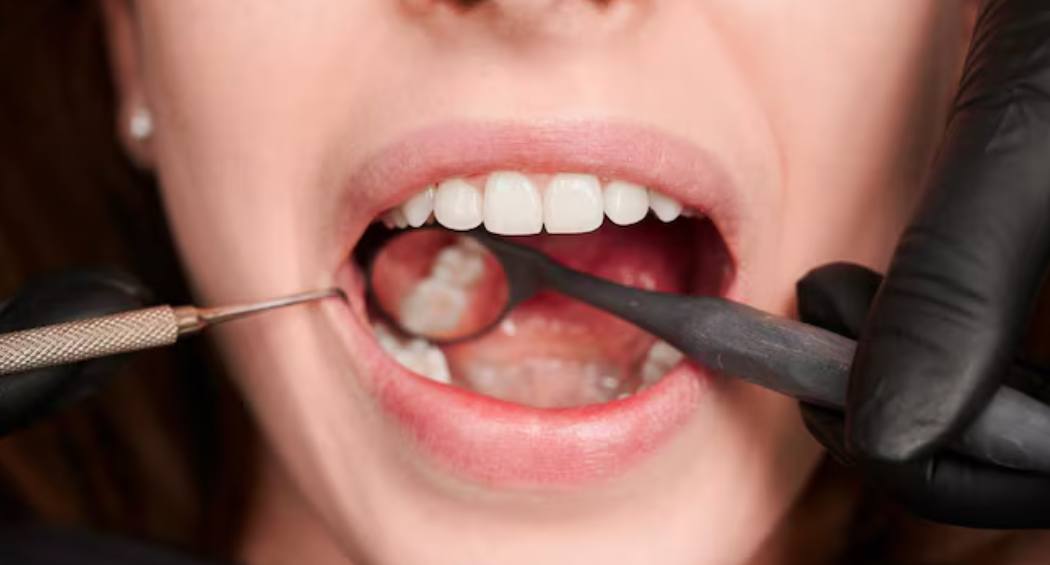 Dental